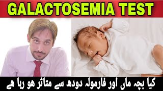 Galactosemia Test  Galactosemia Disease  Galactosemia Kya Hai [upl. by Cyndy175]