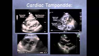 Tutorial Basic echocardiography [upl. by Homans]