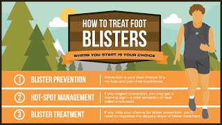 How To Treat Foot Blisters Like A Pro [upl. by Zolly]