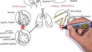 Chronic Kidney Disease CKD Pathophysiology [upl. by Aig]