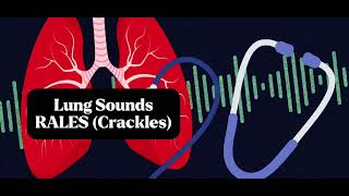 Understanding Rales Crackles Lung Sounds Accurate Lung Assessment [upl. by Sharla131]