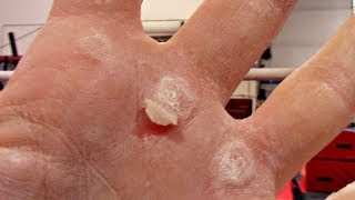 Gymnastics Rip Hacks How To Care For The Rip On Your Hand With Coach Meggin [upl. by Kcirdes423]