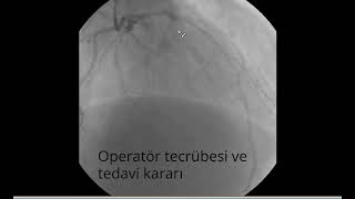 Tecrübeli operatörün bypass kararı az [upl. by Ahtekahs]