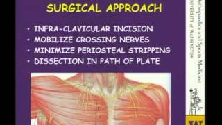 Clavicle Fractures Controversies [upl. by Moyna]