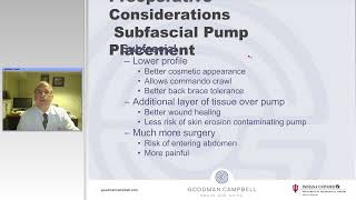 Implantation of Intrathecal Drug Infusion Pumps Technical Nuances Preview [upl. by Sucram]