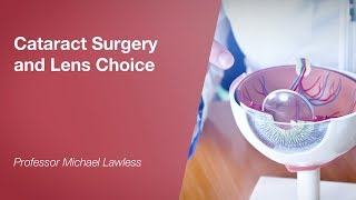 Cataract Surgery and Lens Choice [upl. by Ahsie]