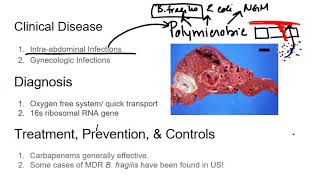 Gram Negative Rods Bacteroidies fragilis [upl. by Alrats]