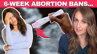 Do 6week abortion bans actually work Doctor explains [upl. by Barstow]