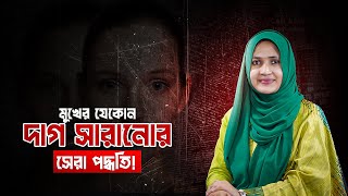 মুখের যেকোন দাগ সারানোর সেরা পদ্ধতি  Dr Shusama Reza [upl. by Fowle]