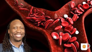 Sickle cell anemia  Studying inflammation mediated vascular permeability with the Maestro Z system [upl. by Ariew298]