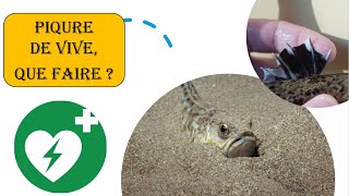 Tout SAVOIR sur les Vives et les Piqûres de Vive Guide Complet de Prévention et de Premiers Secours [upl. by Haiacim]