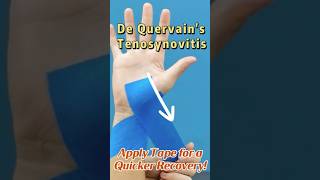 De Quervains Tenosynovitis Tape For INSTANT relief thumbpain wristpain kinesiotape [upl. by Sheila]