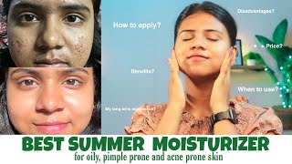 Best moisturizer for summer  Best moisturizer for acne prone skin pimple prone skin oily skin [upl. by Howarth103]