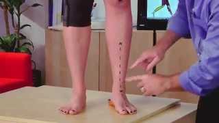 Learn about Pronation and how to Prevent Pronation [upl. by Silvers]