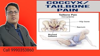 Tail Bone painCoccyx bone pain Cure in Neurotherapy Haldwani [upl. by Manas]