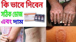 trialon ইনজেকশন এর কাজ কি full review Bangla [upl. by Zaneta]