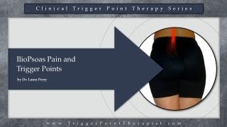 IlioPsoas Pain and Trigger Points [upl. by Yra888]