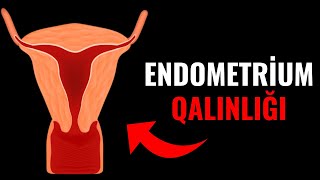 Endometrium Qalınlığı az olduqda Müalicə İlə normal Qalınlığa çatdırmaq olar [upl. by Sparrow]