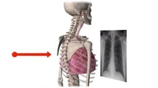 Chest XRay Basics in 5 min [upl. by Anelhtac847]