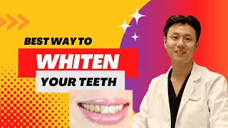 Best Teeth Whitening Method  DENTIST ANSWERS [upl. by Standing]