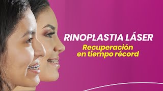 Antes y después Rinoplastia ultrasónica hombres  Dr Macía  Icifacial [upl. by Venola720]