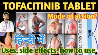 Tofacitinib 5 mg tablet uses side effects how to use in hindi tofacitinib [upl. by Jammie]