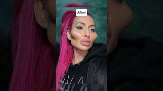 People Before And After Plastic Surgery 😰 pt2shorts viral [upl. by Anwahsar]