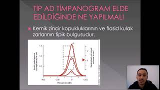 ODYOLOJİDE TİMPANOMETRİK TESTLER VE DEĞERLENDİRİLMELERİ [upl. by Dnomyaw752]