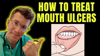 How to recognise and treat Mouth Ulcers getting rid of canker sores  Doctor ODonovan explains [upl. by Sergias]