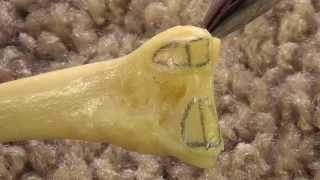 Anatomy and Osteology of 2nd  Second Metatarsal [upl. by Enniotna]