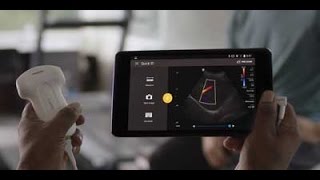 Philips Lumify  Ultrasound on your compatible smart device [upl. by Ardnaxela]