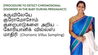 கோரியானிக் வில்லஸ் மாதிரி CVS  கருவிலேயே குரோமோசோம் குறைபாடுகளை அறிய [upl. by Berardo]