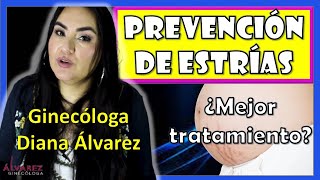 PREVENIR ESTRIAS en el EMBARAZO por GINECOLOGA DIANA ALVAREZ [upl. by Foulk313]