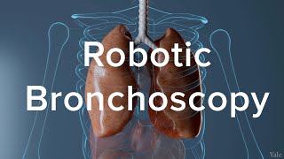 Lung Biopsy Via Robotic Bronchoscopy  Yale Medicine Explains [upl. by Drew]