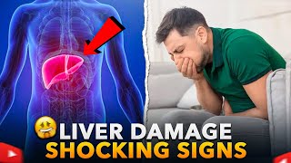 Shocking Signs of Liver Damage You Must Know [upl. by Anirat]