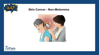 Skin Cancer  NonMelanoma  Quiz [upl. by Wenoa]