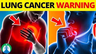 Top 10 Early Warning Signs of Lung Cancer  NEVER IGNORE THIS [upl. by Annnora]