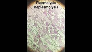 Plasmolysis Deplasmolysis [upl. by Dianthe]