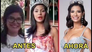 Filtran fotos de la ganadora de Miss Universo 2023 antes de las cirugías parecía otra persona [upl. by Anhsirk224]