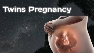 Twins Pregnancy  OBG Lecture [upl. by Hafeetal94]