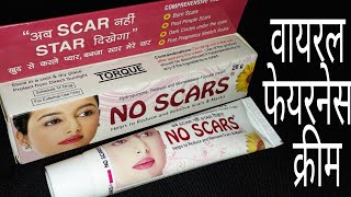 No Scars Cream  गोरेपन की वायरल क्रीम  Review Hindi [upl. by Andreas]