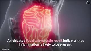 What is a Calprotectin test [upl. by Locke]