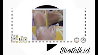 Biotalk Review [upl. by Areit628]