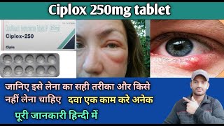 Ciplox 250 tablet use dose benefits and Side effects full review in hindi [upl. by Brockie17]