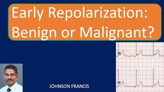 Early Repolarization Benign or Malignant [upl. by Zerdna]