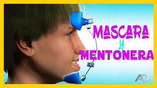 🔺️MENTONERA ortodoncia Y MASCARA FACIAL ortodoncia🔺️PROGNATISMO MANDIBULAR [upl. by Anirtruc296]