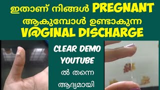 2 Types Of Pregnancy Discharge Deechus world Malayalam [upl. by Toogood709]