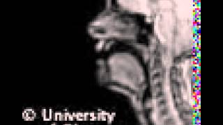 Voiced uvular nasal MRI [upl. by Taryne]