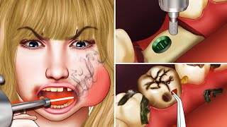 ASMR Broken tooth cavities removal  Dental implant procedure animation [upl. by Ennairol323]