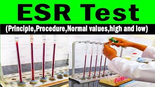 ESR Estimation by Westergren Method [upl. by Aerdied202]